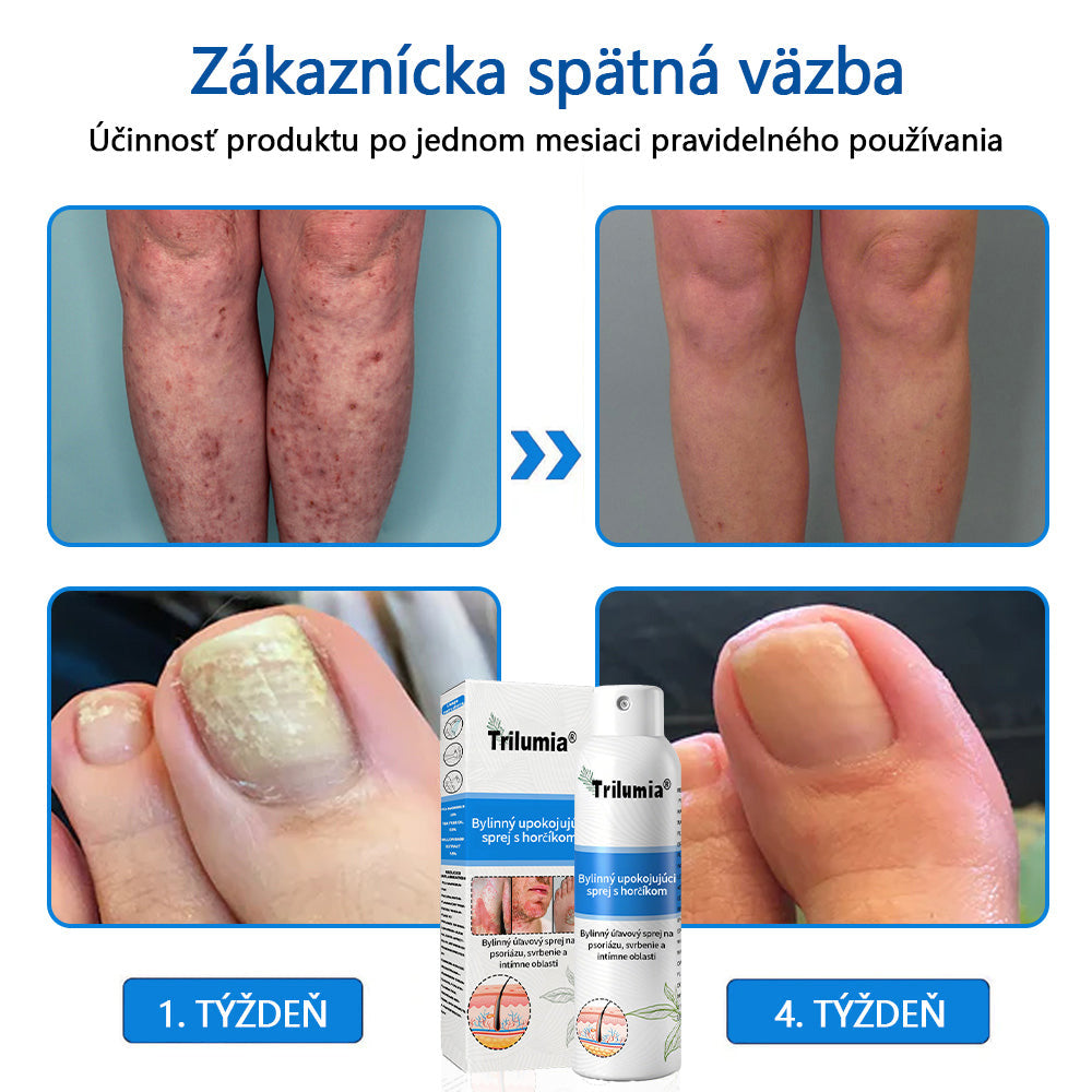 Oficiálny obchod: Trilumia®Horčíkový bylinný sprej na psoriázu⚕️certifikované FDA (úľava od psoriázy a ekzému, zlepšenie bakteriálnych infekcií v oblasti genitálií a liečba akné a tmavých škvŕn)