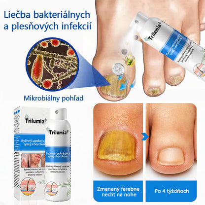 Oficiálny obchod: Trilumia®Horčíkový bylinný sprej na psoriázu⚕️certifikované FDA (úľava od psoriázy a ekzému, zlepšenie bakteriálnych infekcií v oblasti genitálií a liečba akné a tmavých škvŕn)