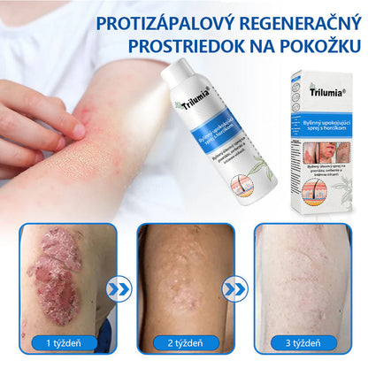 Oficiálny obchod: Trilumia®Horčíkový bylinný sprej na psoriázu⚕️certifikované FDA (úľava od psoriázy a ekzému, zlepšenie bakteriálnych infekcií v oblasti genitálií a liečba akné a tmavých škvŕn)
