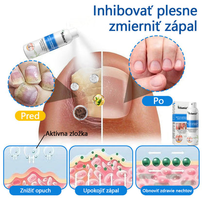 Oficiálny obchod: Trilumia®Horčíkový bylinný sprej na psoriázu⚕️certifikované FDA (úľava od psoriázy a ekzému, zlepšenie bakteriálnych infekcií v oblasti genitálií a liečba akné a tmavých škvŕn)