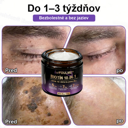 Vyrobené a dodávané z Slovensko ✨⚡ Evolvion® Biotin 10-v-1 krém na regeneráciu pokožky