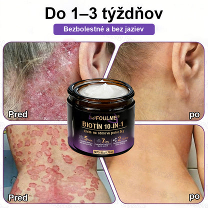 Vyrobené a dodávané z Slovensko ✨⚡ Evolvion® Biotin 10-v-1 krém na regeneráciu pokožky