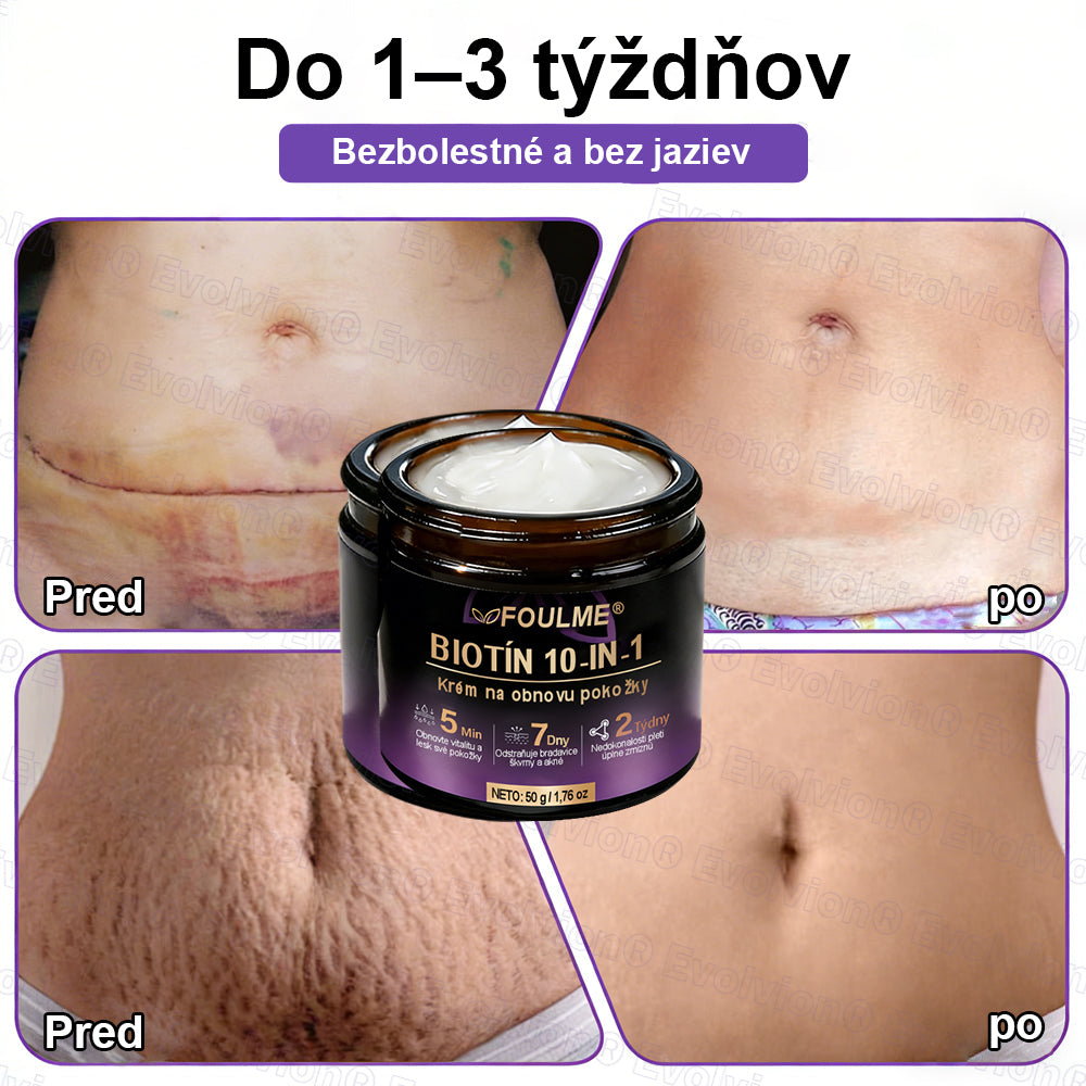 Vyrobené a dodávané z Slovensko ✨⚡ Evolvion® Biotin 10-v-1 krém na regeneráciu pokožky