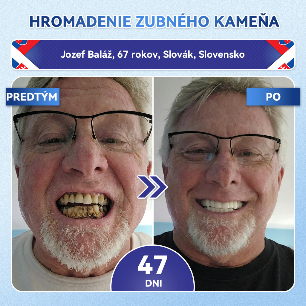 𝐺𝑙𝑖𝑚𝑚𝑒𝑟𝑙𝑦®😁Tideglusib zuby a dasna Rýchlo rozpustné ústne pásiky Repair🦷🦷