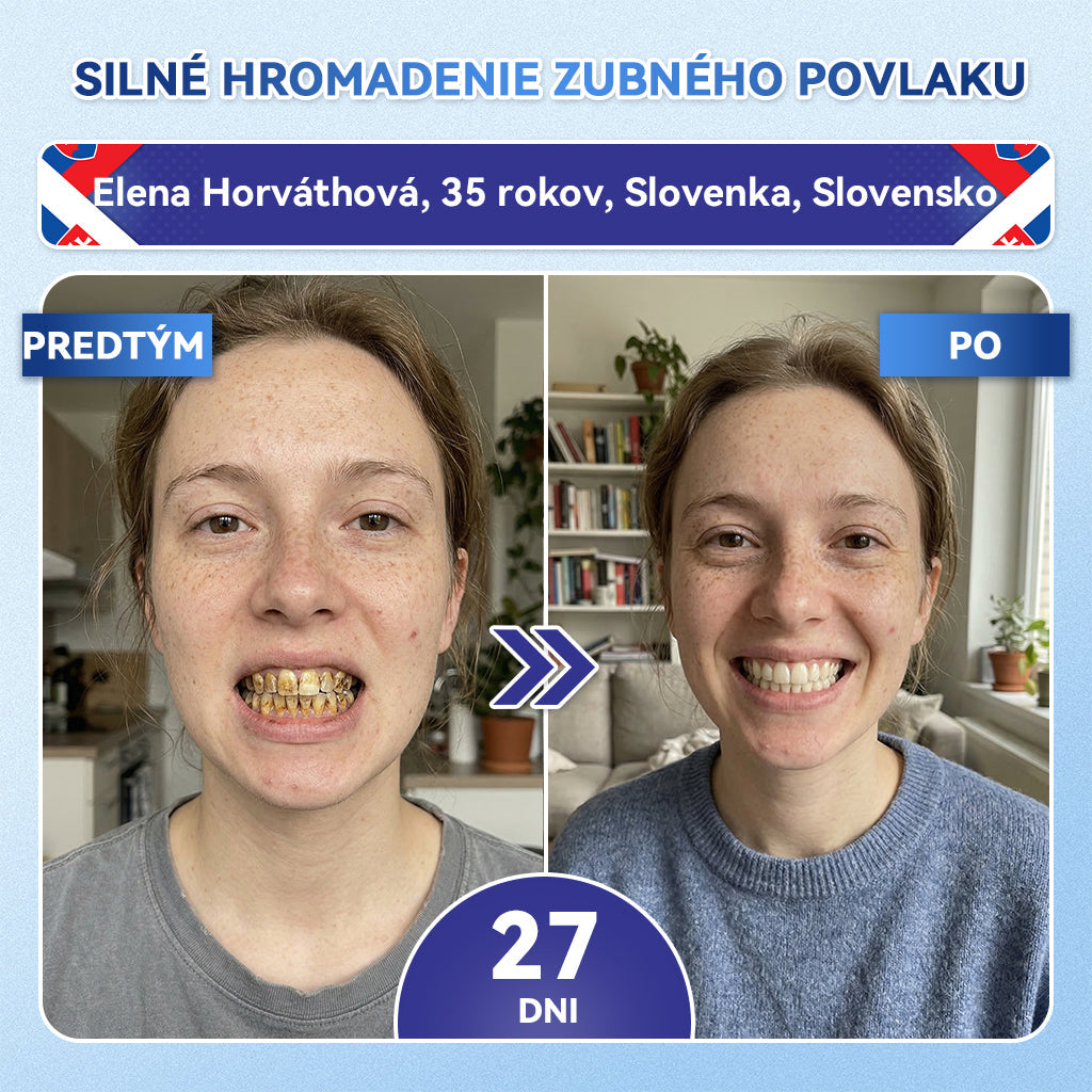 𝐺𝑙𝑖𝑚𝑚𝑒𝑟𝑙𝑦®😁Tideglusib zuby a dasna Rýchlo rozpustné ústne pásiky Repair🦷🦷