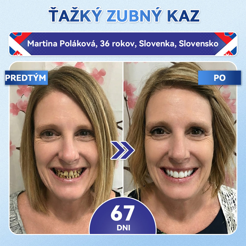 𝐺𝑙𝑖𝑚𝑚𝑒𝑟𝑙𝑦®😁Tideglusib zuby a dasna Rýchlo rozpustné ústne pásiky Repair🦷🦷