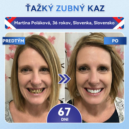 𝐺𝑙𝑖𝑚𝑚𝑒𝑟𝑙𝑦®😁Tideglusib zuby a dasna Rýchlo rozpustné ústne pásiky Repair🦷🦷