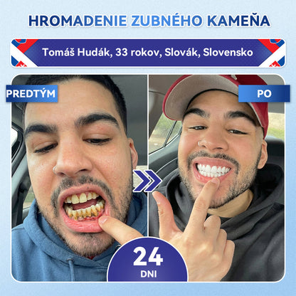 𝐺𝑙𝑖𝑚𝑚𝑒𝑟𝑙𝑦®😁Tideglusib zuby a dasna Rýchlo rozpustné ústne pásiky Repair🦷🦷