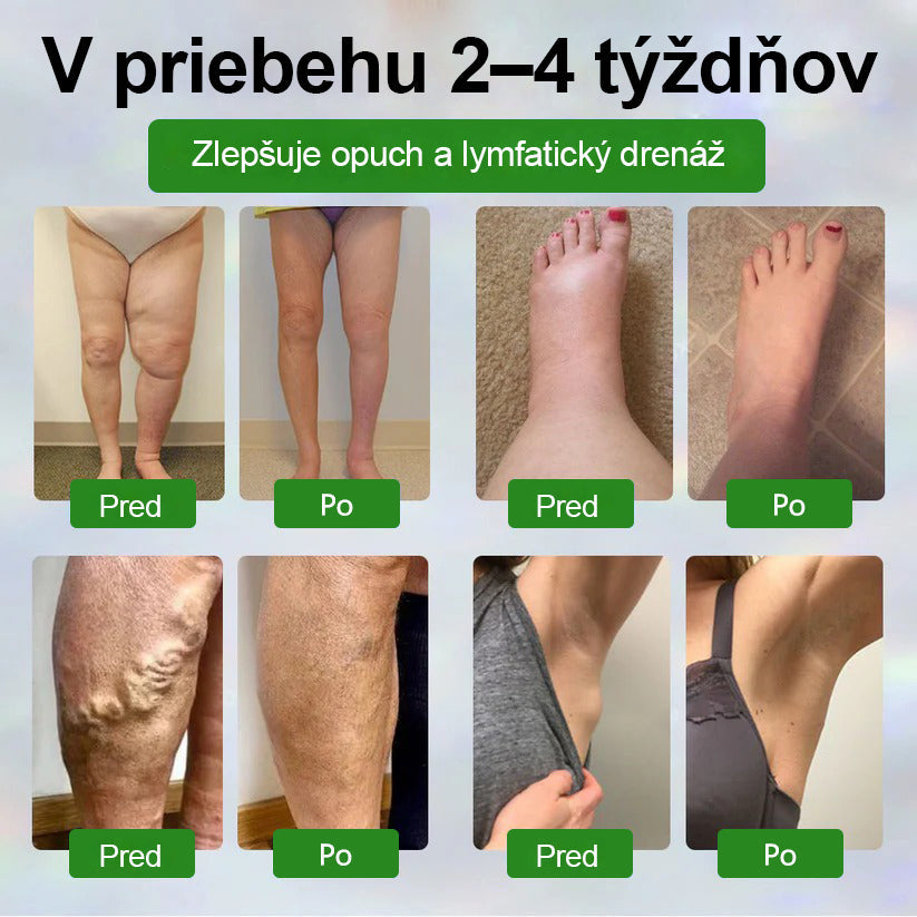 Dorina® Bylinný krém na zmiernenie opuchov s čiernou rascou.