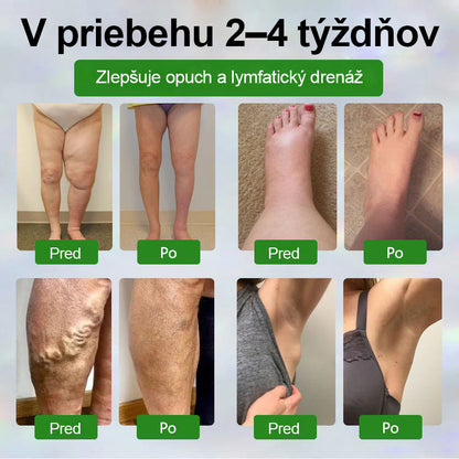 Dorina® Bylinný krém na zmiernenie opuchov s čiernou rascou.