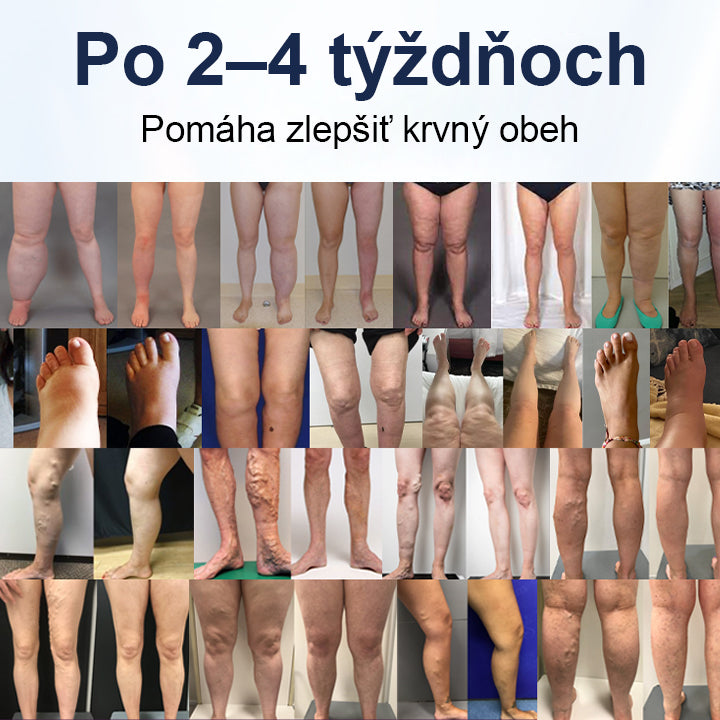 COLTURE® SwellRelief Krém na podporu krvného obehu🔥🔥