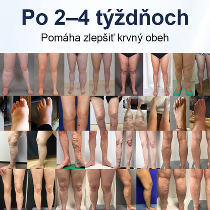 COLTURE® SwellRelief Krém na podporu krvného obehu🔥🔥