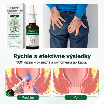 Foulme® SootheMist PRO sprej proti hemoroidom