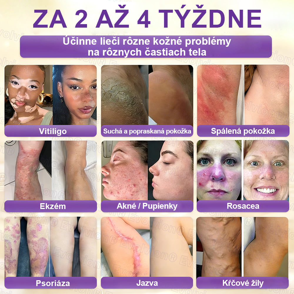 Vyrobené a dodávané z Slovensko ✨⚡ Evolvion® Biotin 10-v-1 krém na regeneráciu pokožky
