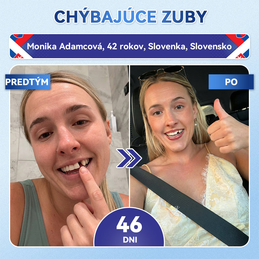 𝐺𝑙𝑖𝑚𝑚𝑒𝑟𝑙𝑦®😁Tideglusib zuby a dasna Rýchlo rozpustné ústne pásiky Repair🦷🦷