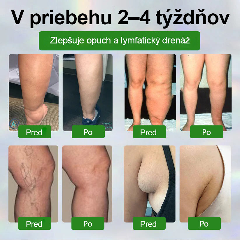 Dorina® Bylinný krém na zmiernenie opuchov s čiernou rascou.
