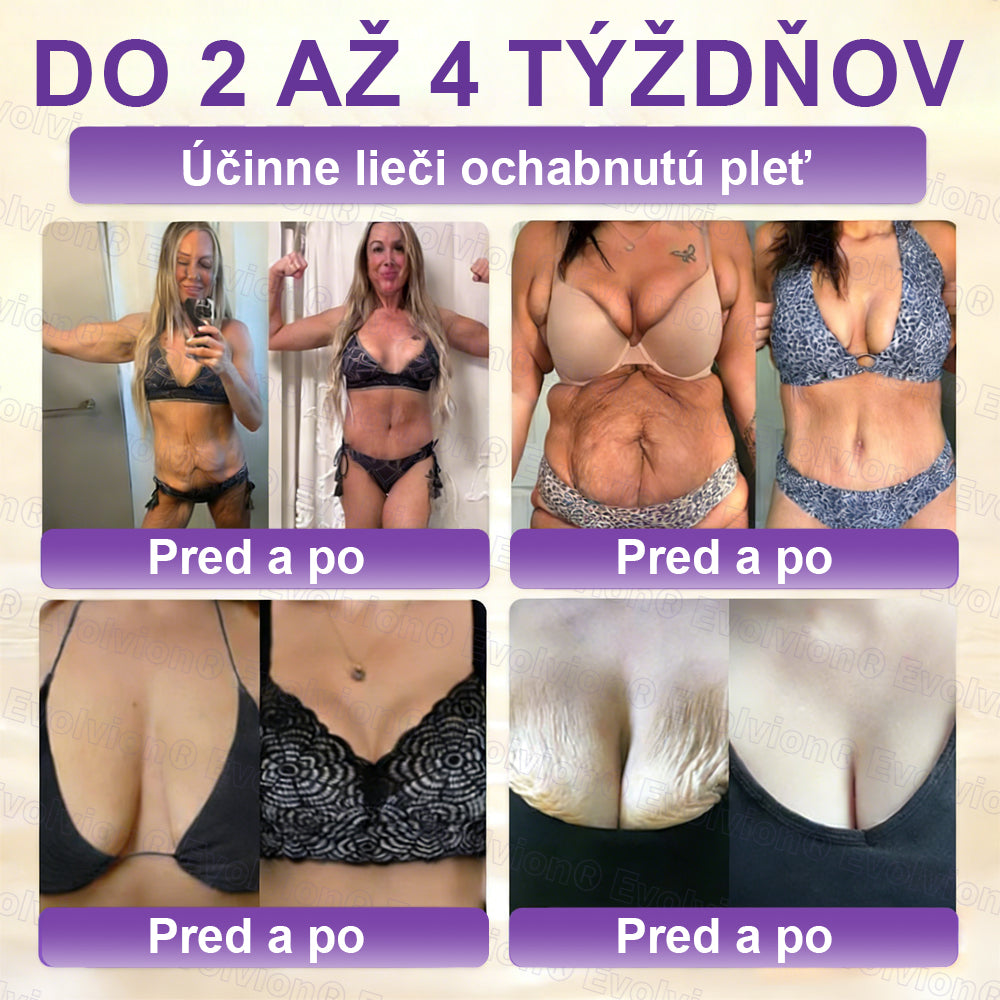 Vyrobené a dodávané z Slovensko ✨⚡ Evolvion® Biotin 10-v-1 krém na regeneráciu pokožky