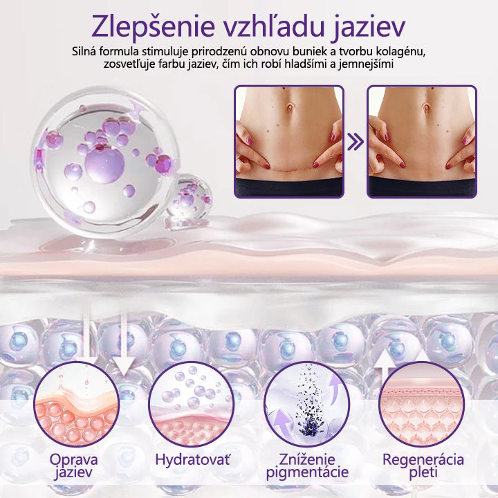FOULME® ReGenScar gél na jazvy s kmeňovými bunkami