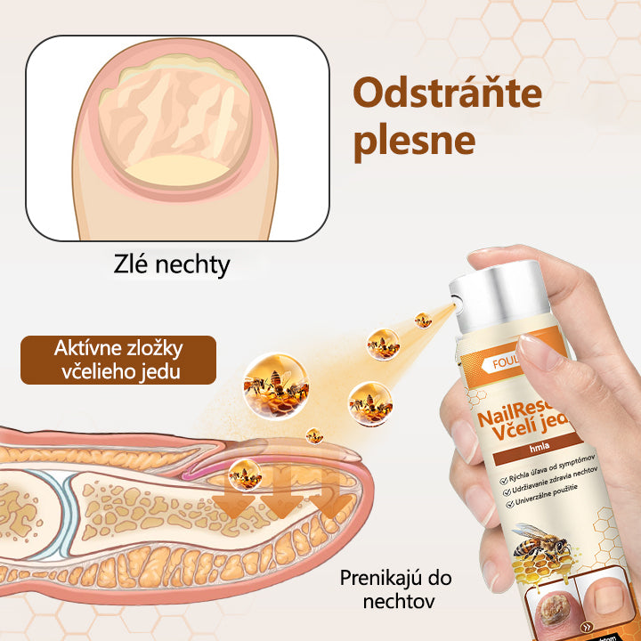 2026🎁 Limitovaná akcia 70% ZĽAVA ️ ️⏳ FOULME® Sprej na nechtovú hubu s včelím jedom 💥 Oprava všetkých problémov s nechtami do 2 týždňov✨✨