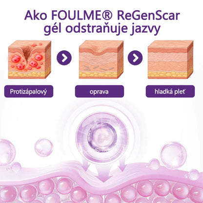 FOULME® ReGenScar gél na jazvy s kmeňovými bunkami