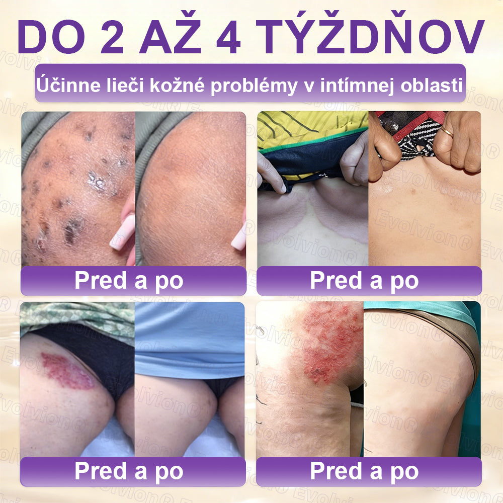 Vyrobené a dodávané z Slovensko ✨⚡ Evolvion® Biotin 10-v-1 krém na regeneráciu pokožky