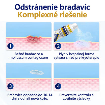 ❄️Foulme® ChillErase obnovujúci sprej proti kožným výrastkom