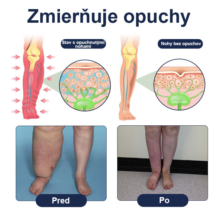 COLTURE® SwellRelief Krém na podporu krvného obehu🔥🔥