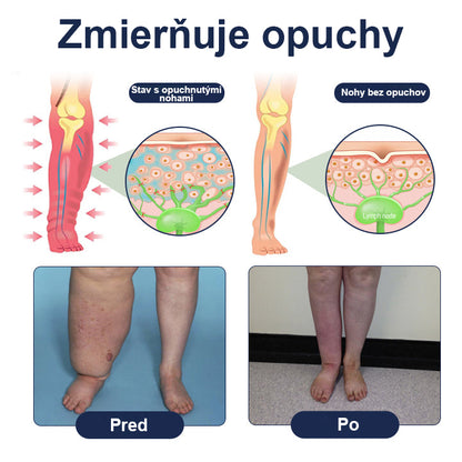COLTURE® SwellRelief Krém na podporu krvného obehu🔥🔥