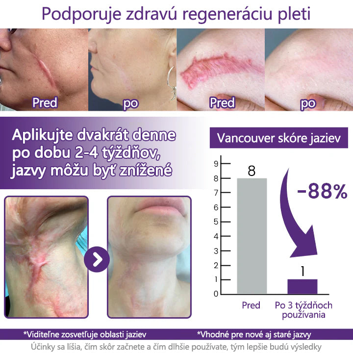 FOULME® ReGenScar gél na jazvy s kmeňovými bunkami