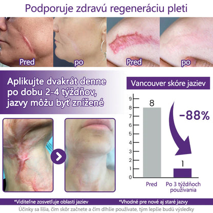 FOULME® ReGenScar gél na jazvy s kmeňovými bunkami