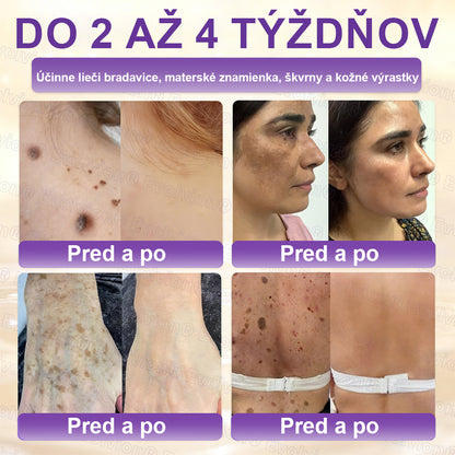 Vyrobené a dodávané z Slovensko ✨⚡ Evolvion® Biotin 10-v-1 krém na regeneráciu pokožky