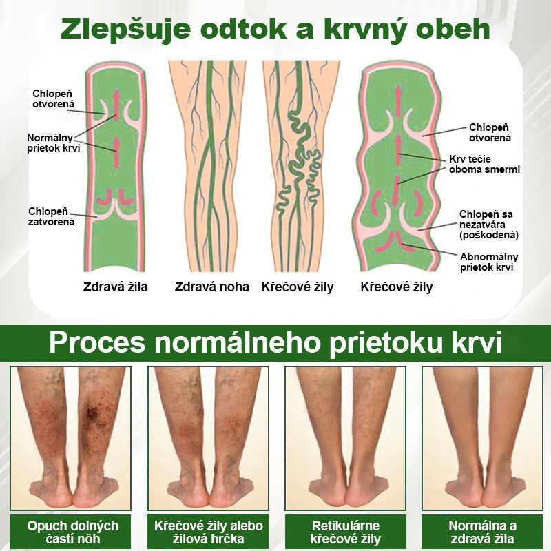 Dorina® Bylinný krém na zmiernenie opuchov s čiernou rascou.