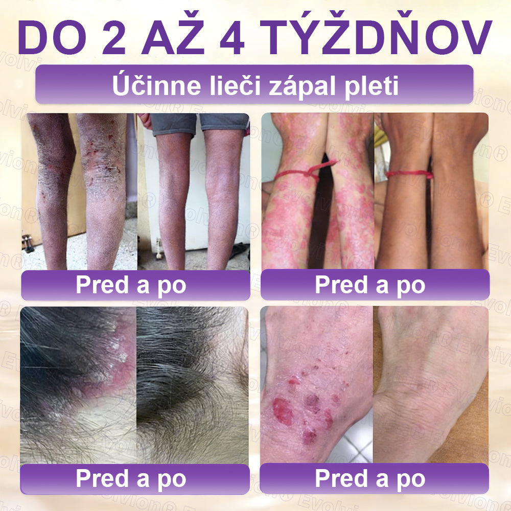 Vyrobené a dodávané z Slovensko ✨⚡ Evolvion® Biotin 10-v-1 krém na regeneráciu pokožky