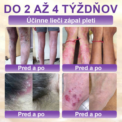 Vyrobené a dodávané z Slovensko ✨⚡ Evolvion® Biotin 10-v-1 krém na regeneráciu pokožky