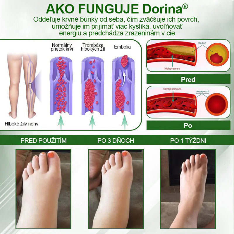 Dorina® Bylinný krém na zmiernenie opuchov s čiernou rascou.