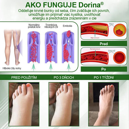 Dorina® Bylinný krém na zmiernenie opuchov s čiernou rascou.