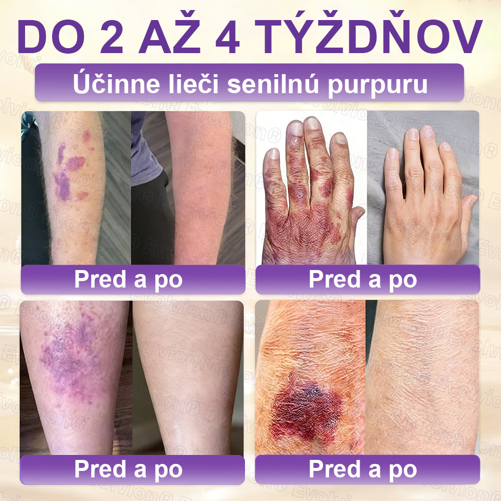 Vyrobené a dodávané z Slovensko ✨⚡ Evolvion® Biotin 10-v-1 krém na regeneráciu pokožky
