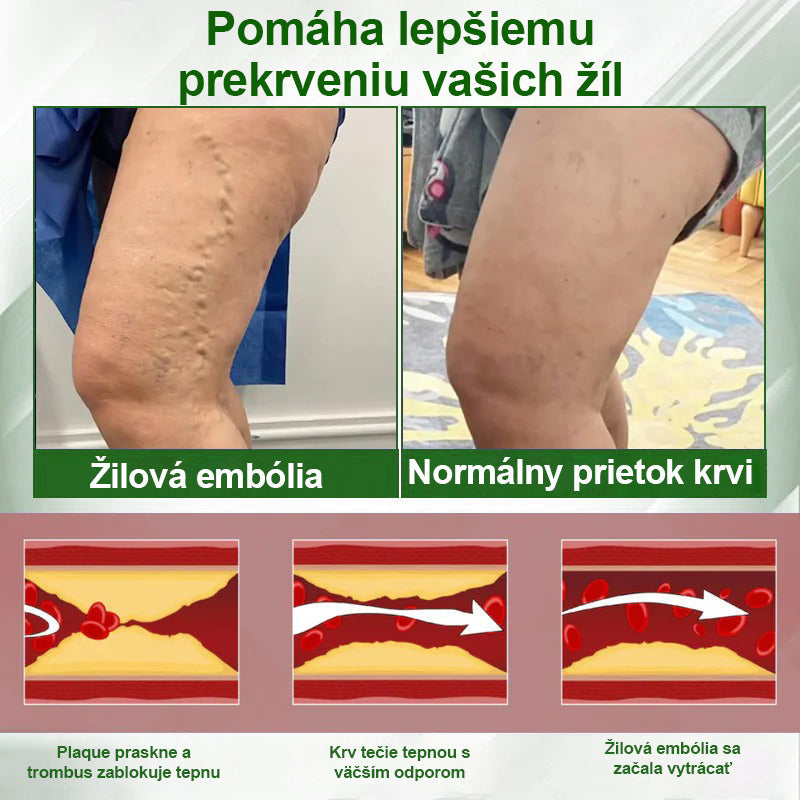 Dorina® Bylinný krém na zmiernenie opuchov s čiernou rascou.