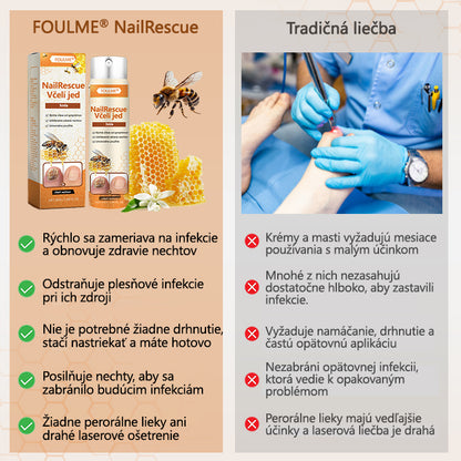 2026🎁 Limitovaná akcia 70% ZĽAVA ️ ️⏳ FOULME® Sprej na nechtovú hubu s včelím jedom 💥 Oprava všetkých problémov s nechtami do 2 týždňov✨✨