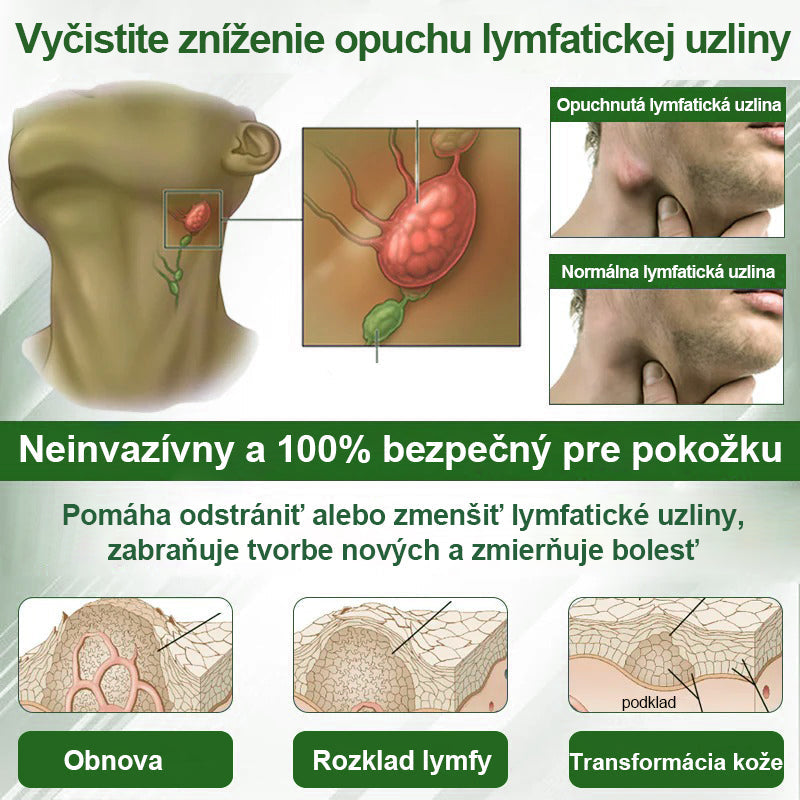 Dorina® Bylinný krém na zmiernenie opuchov s čiernou rascou.