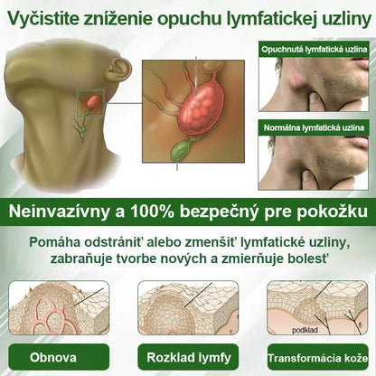 Dorina® Bylinný krém na zmiernenie opuchov s čiernou rascou.