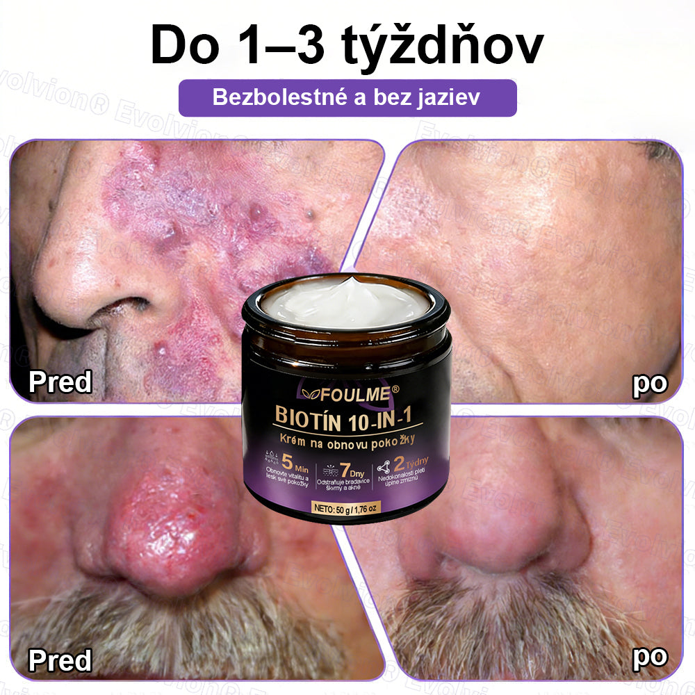 Vyrobené a dodávané z Slovensko ✨⚡ Evolvion® Biotin 10-v-1 krém na regeneráciu pokožky