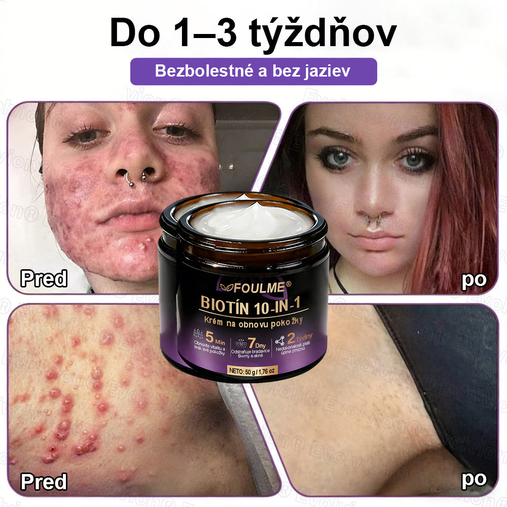Vyrobené a dodávané z Slovensko ✨⚡ Evolvion® Biotin 10-v-1 krém na regeneráciu pokožky